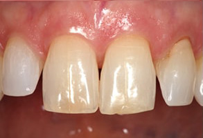 dental images 61401